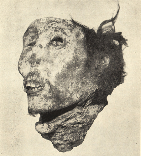 Один из повешенных Джимми Ах Сю, мозг которого Маклай извлек непосредственно после казни. Хранится в музее Маклая Сиднейского университета.